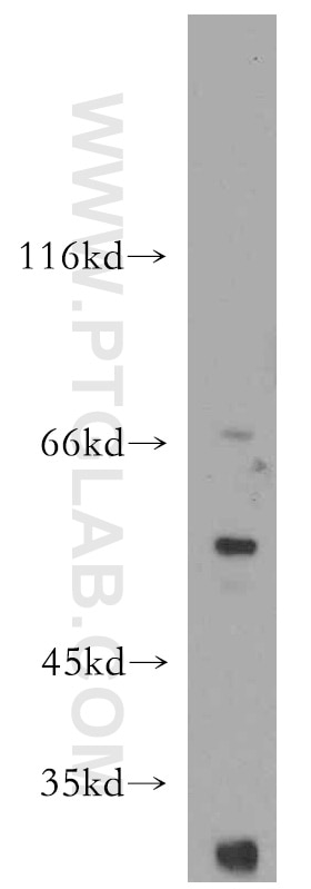 Western Blot (WB) analysis of MCF-7 cells using WT1 Polyclonal antibody (12609-1-AP)