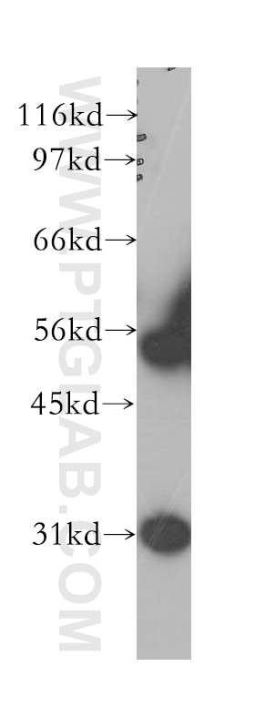 WT1 Polyclonal antibody