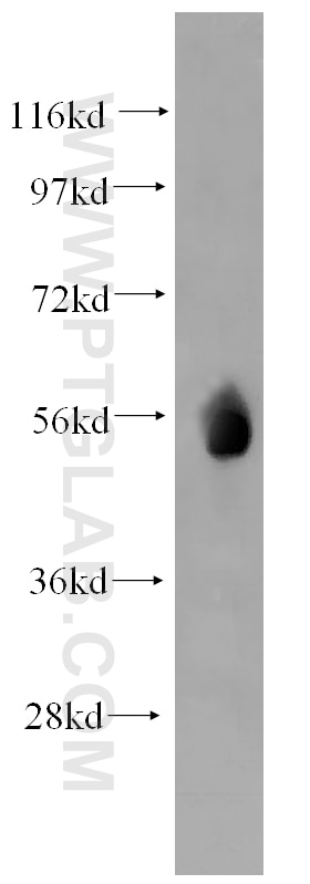 Western Blot (WB) analysis of human liver tissue using WT1 Polyclonal antibody (12609-1-AP)