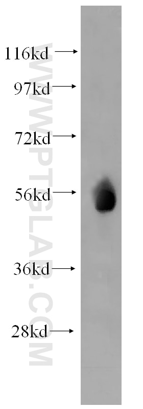 WB analysis of human liver using 12609-1-AP