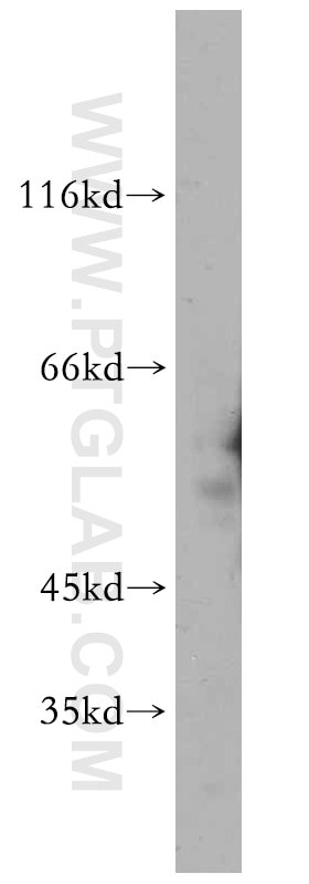 Western Blot (WB) analysis of K-562 cells using WT1 Polyclonal antibody (12609-1-AP)