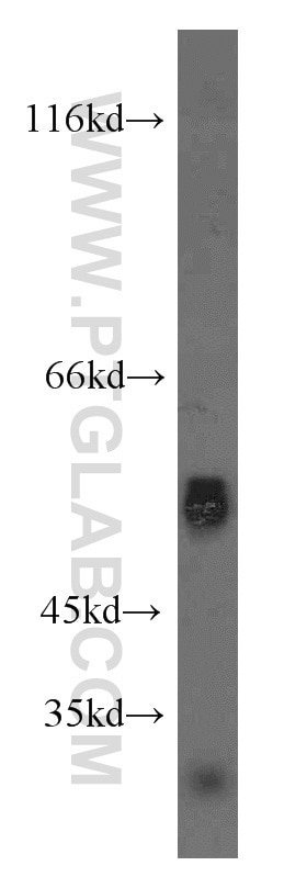 Western Blot (WB) analysis of A431 cells using WT1 Polyclonal antibody (12609-1-AP)