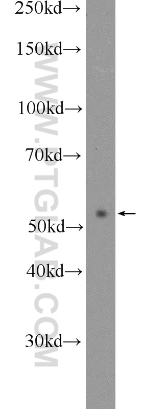 Western Blot (WB) analysis of mouse kidney tissue using WT1 Polyclonal antibody (23235-1-AP)