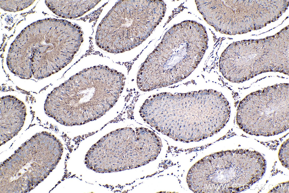 Immunohistochemistry (IHC) staining of rat testis tissue using WT1 Recombinant antibody (82525-1-RR)