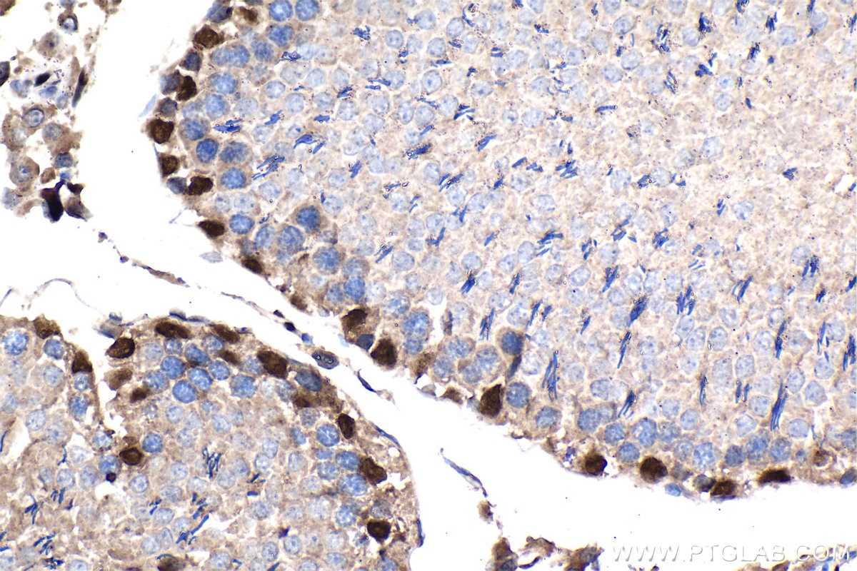 Immunohistochemistry (IHC) staining of rat testis tissue using WT1 Recombinant antibody (82525-1-RR)