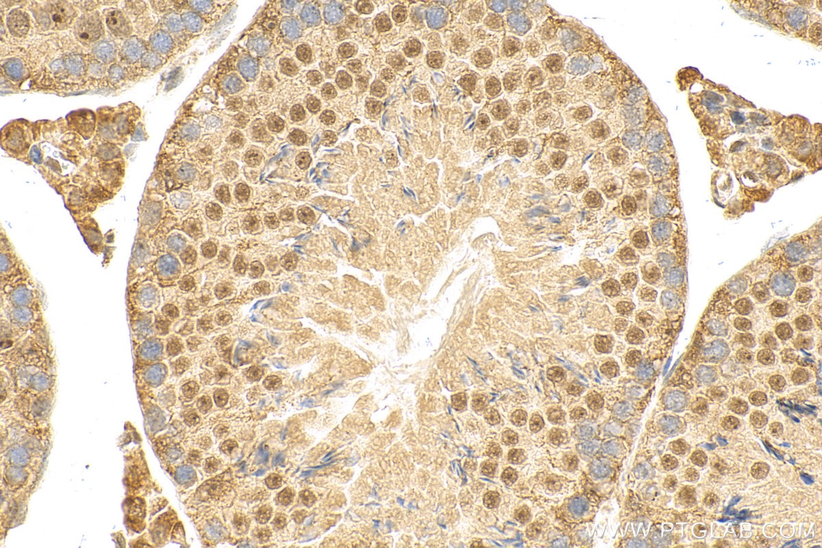 Immunohistochemistry (IHC) staining of mouse testis tissue using WT1 Recombinant antibody (82525-1-RR)