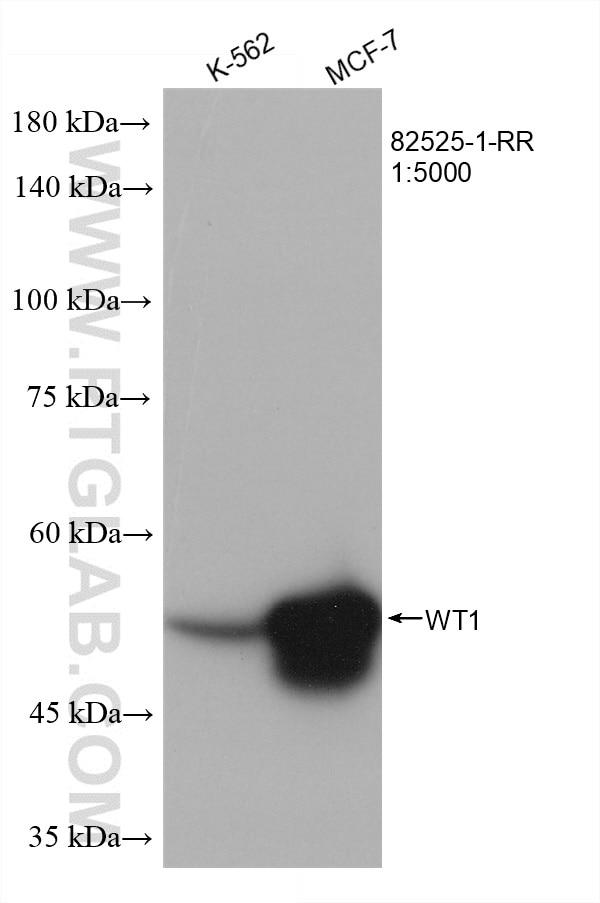 Western Blot (WB) analysis of various lysates using WT1 Recombinant antibody (82525-1-RR)