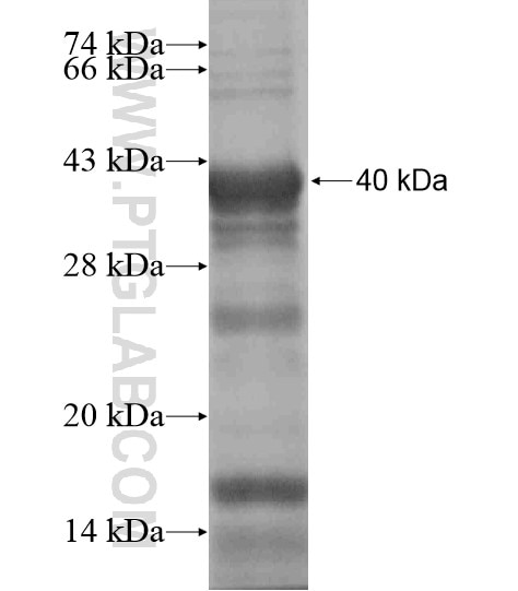 WT1 fusion protein Ag19541 SDS-PAGE