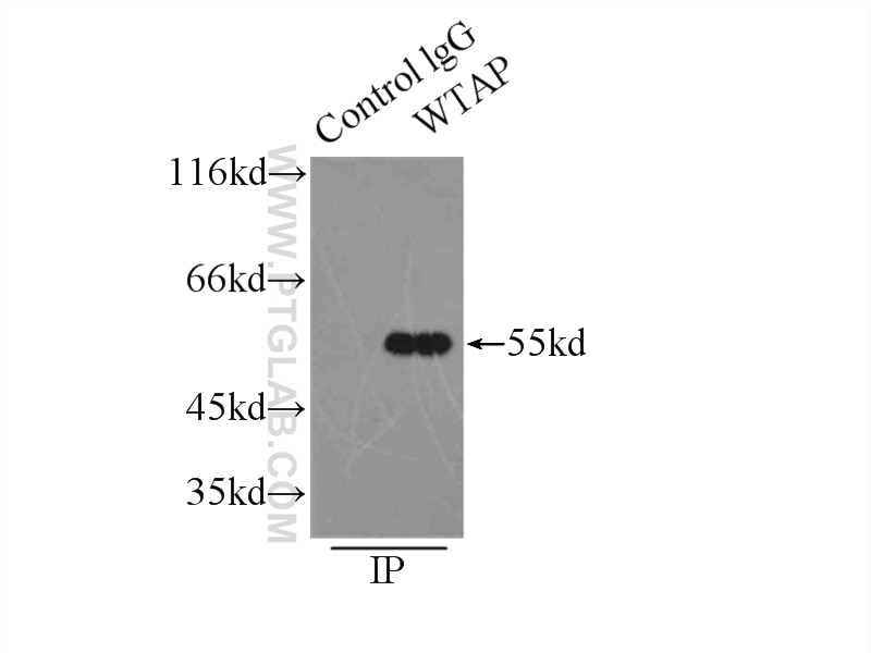 Immunoprecipitation (IP) experiment of HEK-293 cells using WTAP Polyclonal antibody (10200-1-AP)
