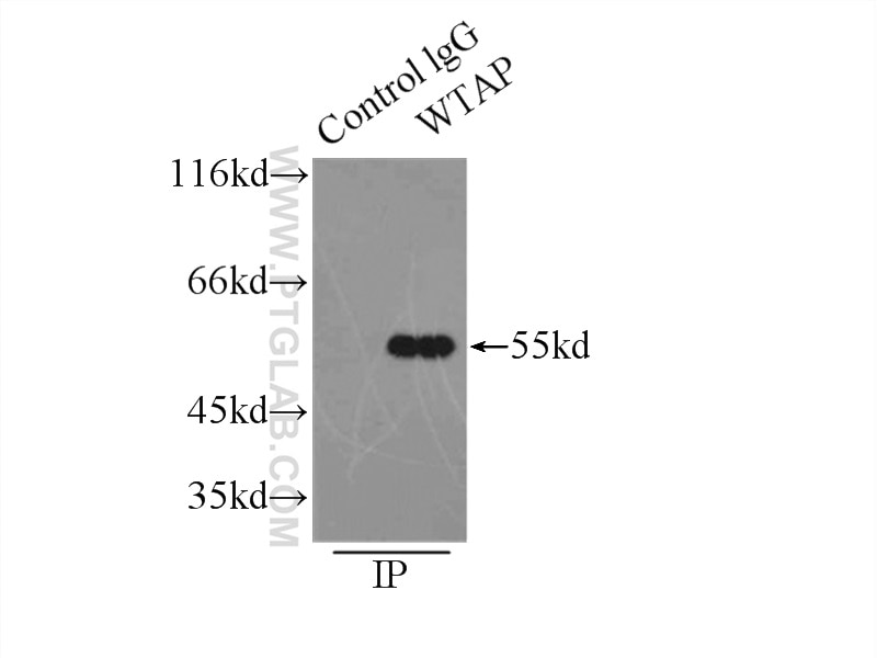 IP experiment of HEK-293 using 10200-1-AP