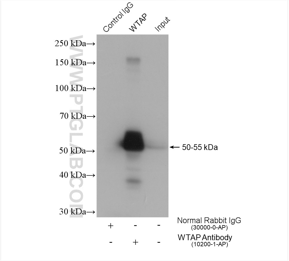 Immunoprecipitation (IP) experiment of Jurkat cells using WTAP Polyclonal antibody (10200-1-AP)