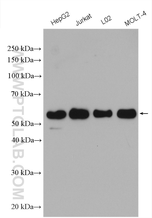 Western Blot (WB) analysis of various lysates using WTAP Polyclonal antibody (10200-1-AP)