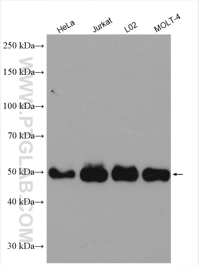 Western Blot (WB) analysis of various lysates using WTAP Polyclonal antibody (10200-1-AP)