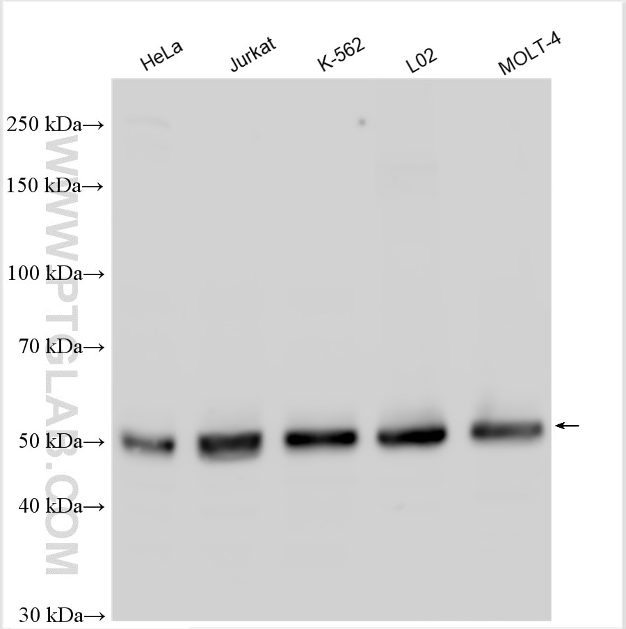 Western Blot (WB) analysis of HeLa cells using WTAP Polyclonal antibody (10200-1-AP)