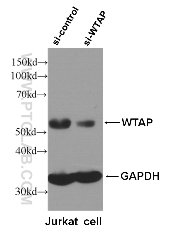 Western Blot (WB) analysis of Jurkat cells using WTAP Polyclonal antibody (10200-1-AP)
