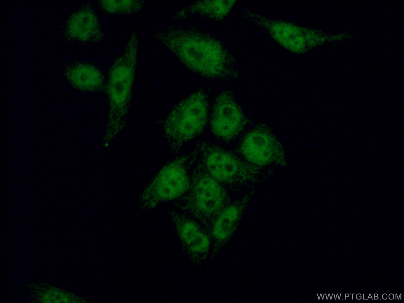 Immunofluorescence (IF) / fluorescent staining of HeLa cells using WTAP Monoclonal antibody (60188-1-Ig)