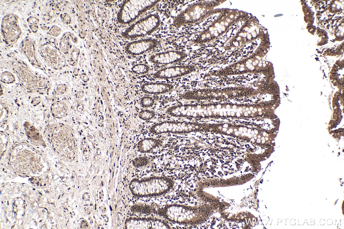 Immunohistochemistry (IHC) staining of human colon tissue using WTAP Monoclonal antibody (60188-1-Ig)