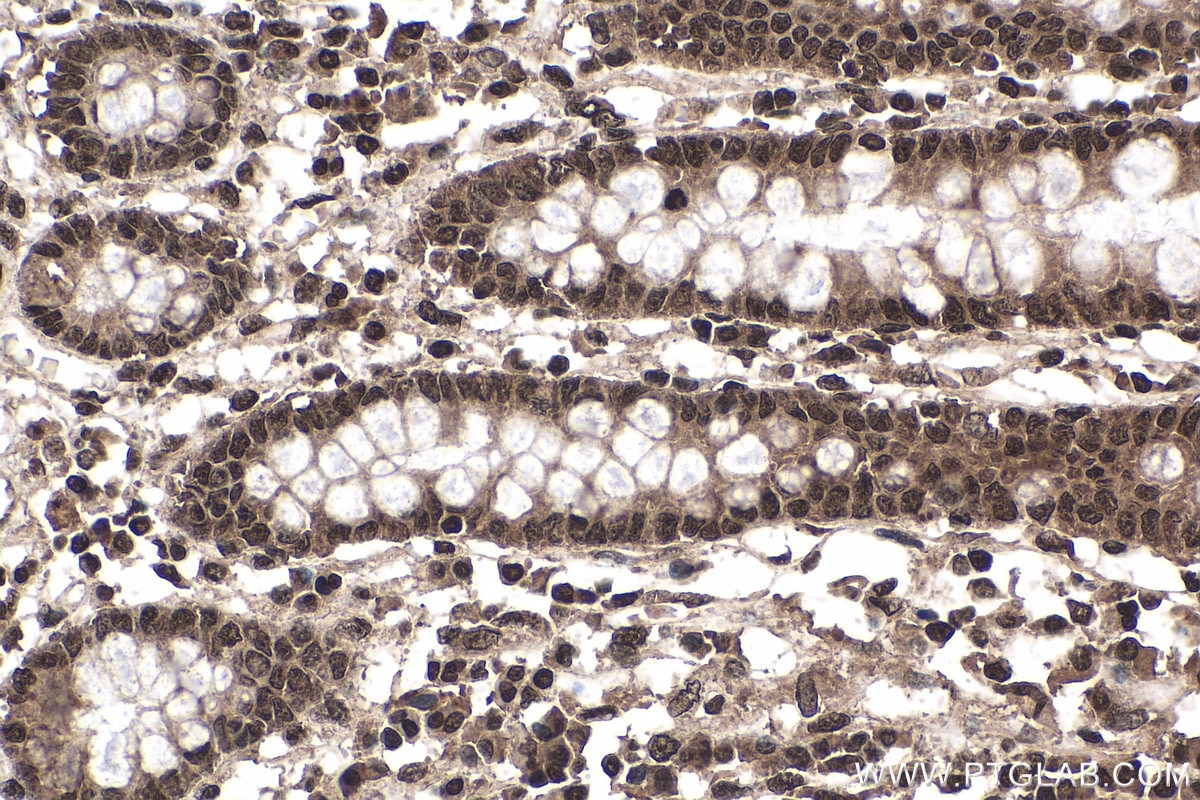 Immunohistochemistry (IHC) staining of human colon tissue using WTAP Monoclonal antibody (60188-1-Ig)