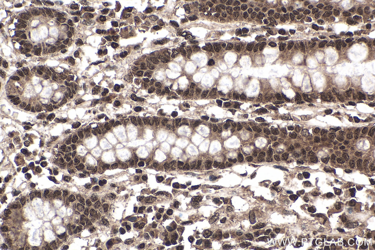 IHC staining of human colon using 60188-1-Ig