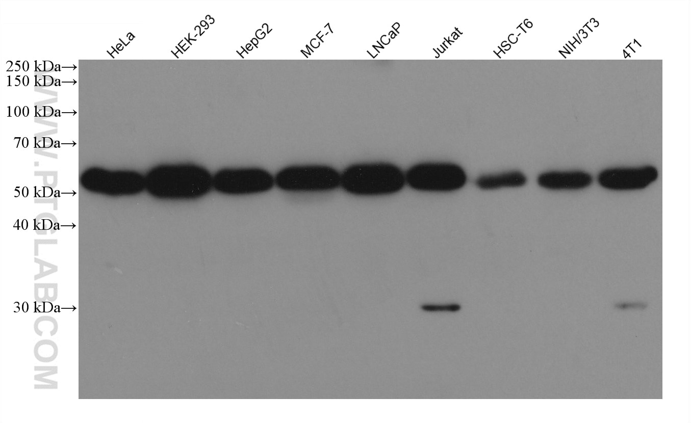 Western Blot (WB) analysis of various lysates using WTAP Monoclonal antibody (60188-1-Ig)