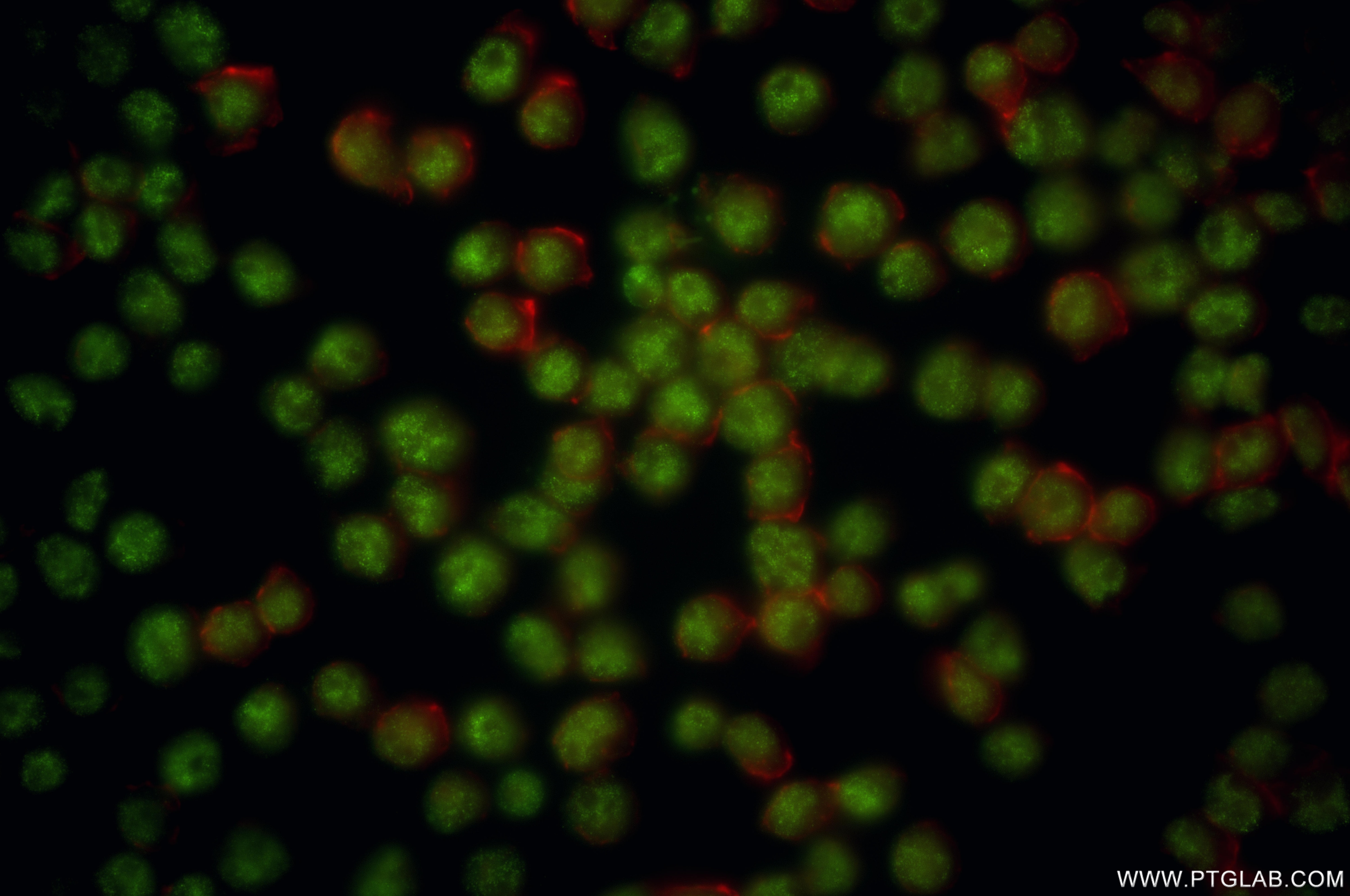 Immunofluorescence (IF) / fluorescent staining of Jurkat cells using WTAP Recombinant antibody (81987-4-RR)