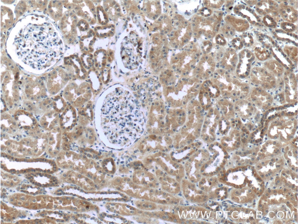 Immunohistochemistry (IHC) staining of human kidney tissue using WTX Polyclonal antibody (55432-1-AP)