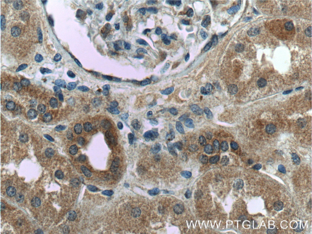 Immunohistochemistry (IHC) staining of human kidney tissue using WTX Polyclonal antibody (55432-1-AP)