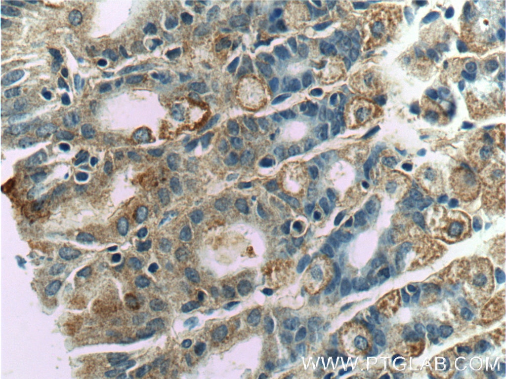 Immunohistochemistry (IHC) staining of mouse stomach tissue using WTX Polyclonal antibody (55432-1-AP)