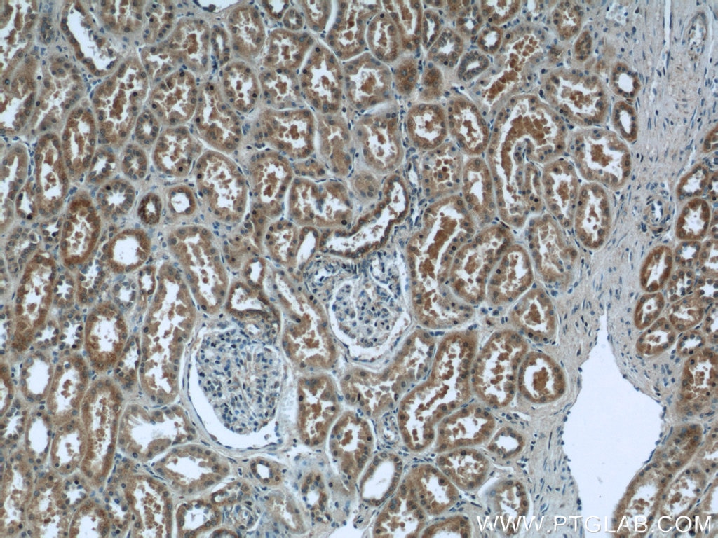 Immunohistochemistry (IHC) staining of human kidney tissue using WWC2 Polyclonal antibody (24750-1-AP)