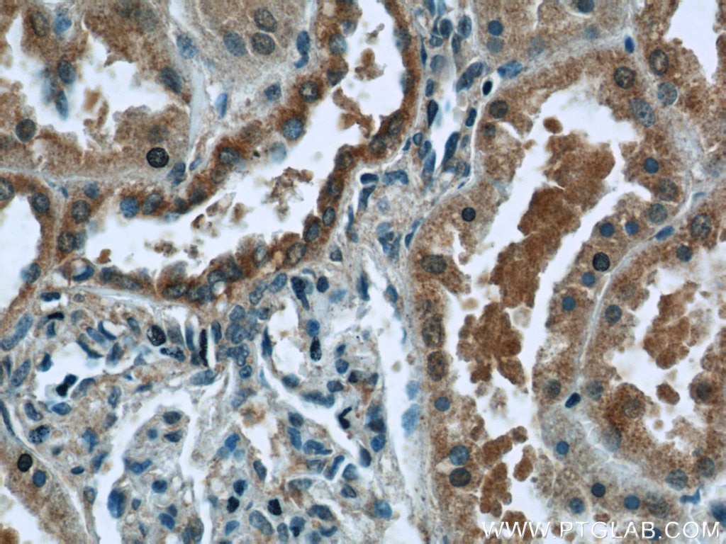 Immunohistochemistry (IHC) staining of human kidney tissue using WWC2 Polyclonal antibody (24750-1-AP)