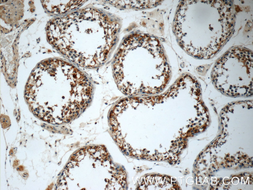 Immunohistochemistry (IHC) staining of human testis tissue using WWC2 Polyclonal antibody (24750-1-AP)