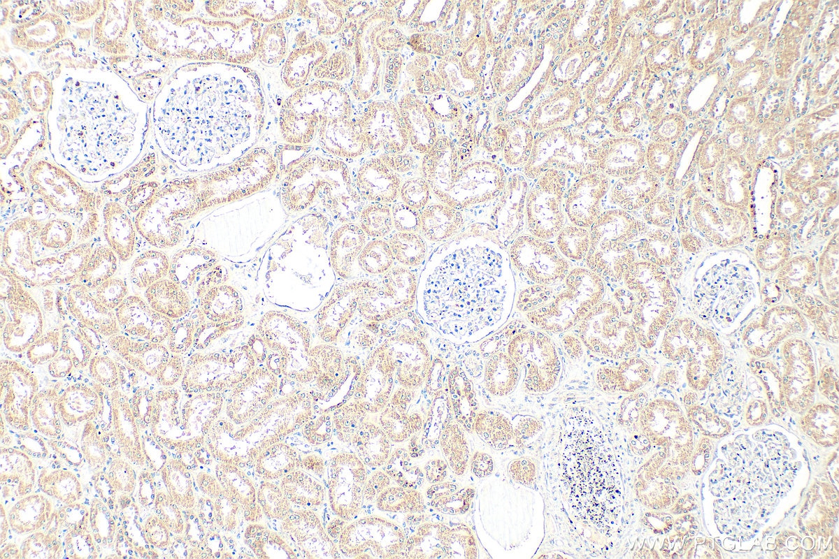 Immunohistochemical analysis of paraffin-embedded human kidney tissue slide using 24750-1-AP (WWC2 antibody) at dilution of 1:400 (under 10x lens). Heat mediated antigen retrieval with Tris-EDTA buffer (pH 9.0). Immunohistochemistry (IHC) staining of human kidney tissue using WWC2 Polyclonal antibody (24750-1-AP)