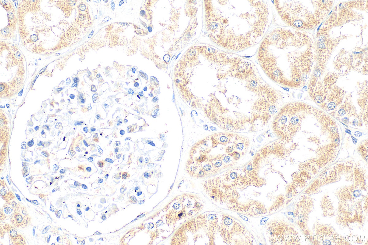 Immunohistochemical analysis of paraffin-embedded human kidney tissue slide using 24750-1-AP (WWC2 antibody) at dilution of 1:400 (under 40x lens). Heat mediated antigen retrieval with Tris-EDTA buffer (pH 9.0). Immunohistochemistry (IHC) staining of human kidney tissue using WWC2 Polyclonal antibody (24750-1-AP)