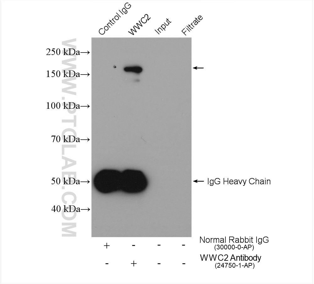 Immunoprecipitation (IP) experiment of HEK-293 cells using WWC2 Polyclonal antibody (24750-1-AP)