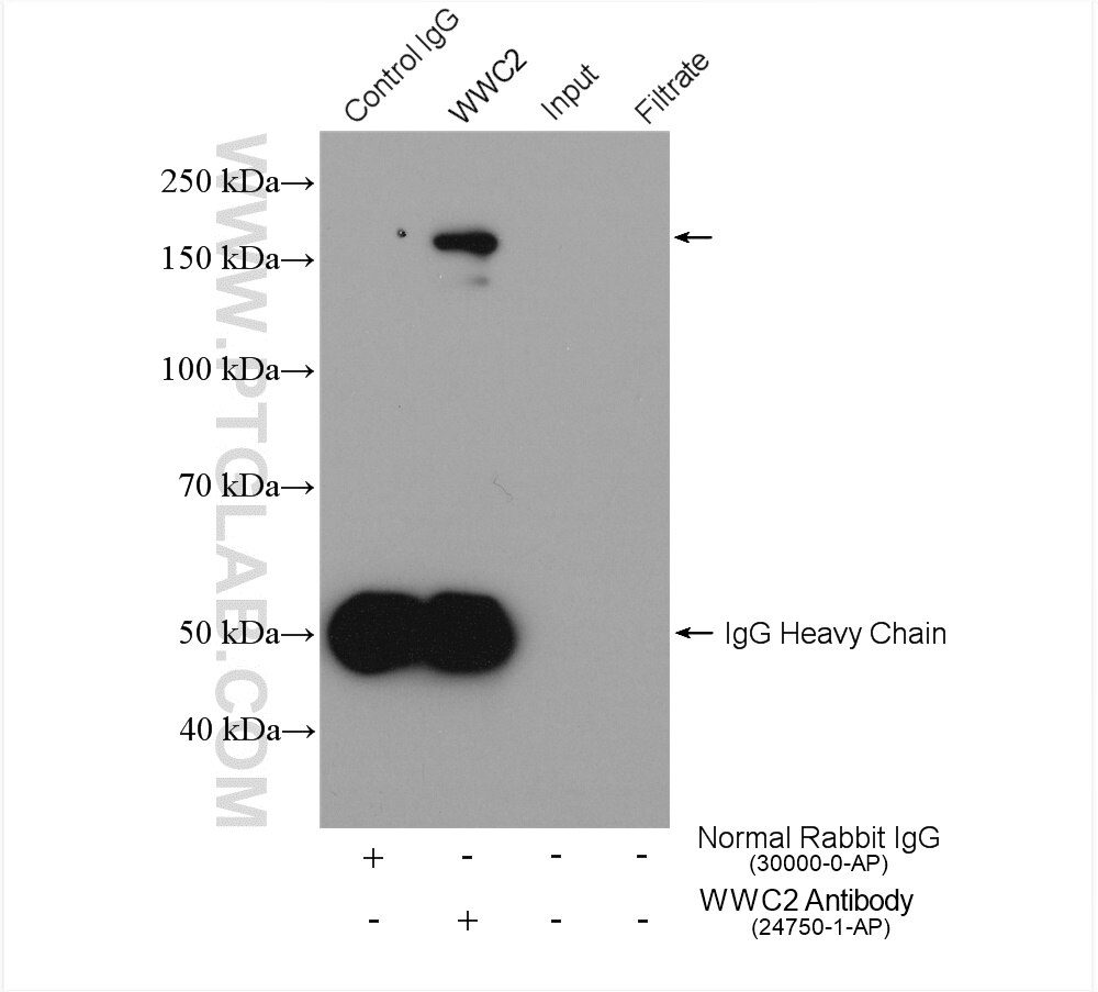 Immunoprecipitation (IP) experiment of HEK-293 cells using WWC2 Polyclonal antibody (24750-1-AP)