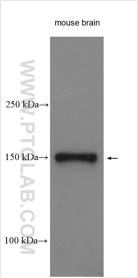 Western Blot (WB) analysis of various lysates using WWC2 Polyclonal antibody (24750-1-AP)