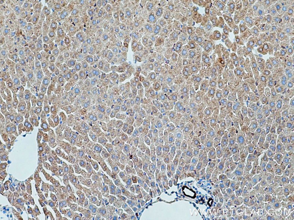 Immunohistochemistry (IHC) staining of mouse liver tissue using WWOX Polyclonal antibody (15299-1-AP)