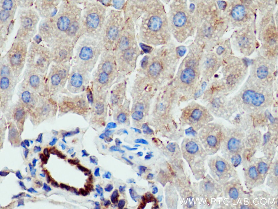 Immunohistochemistry (IHC) staining of mouse liver tissue using WWOX Polyclonal antibody (15299-1-AP)