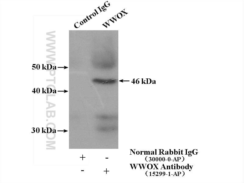 Immunoprecipitation (IP) experiment of mouse skeletal muscle tissue using WWOX Polyclonal antibody (15299-1-AP)