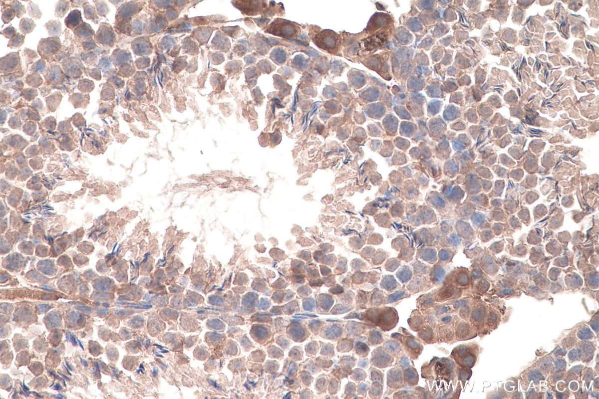 Immunohistochemistry (IHC) staining of mouse testis tissue using WWOX Monoclonal antibody (67725-1-Ig)
