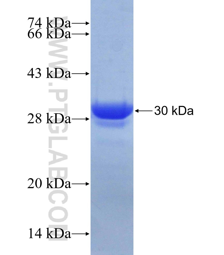 WWOX fusion protein Ag7969 SDS-PAGE