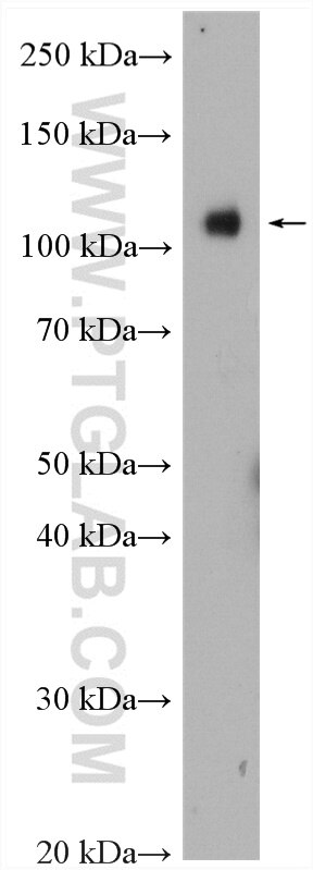 Western Blot (WB) analysis of HeLa cells using WWP1 Polyclonal antibody (28689-1-AP)