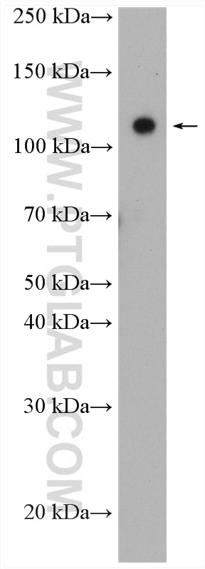 Western Blot (WB) analysis of MCF-7 cells using WWP1 Polyclonal antibody (28689-1-AP)