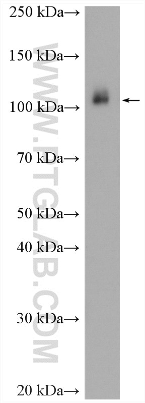 Western Blot (WB) analysis of A431 cells using WWP1 Polyclonal antibody (28689-1-AP)