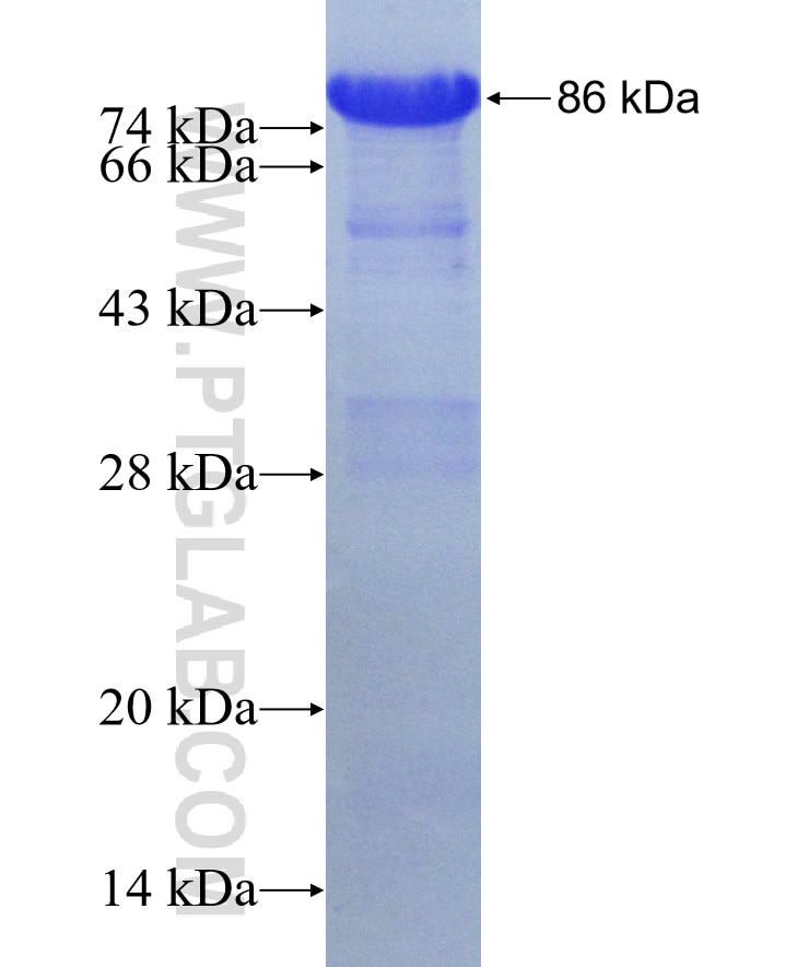 WWP1 fusion protein Ag30161 SDS-PAGE