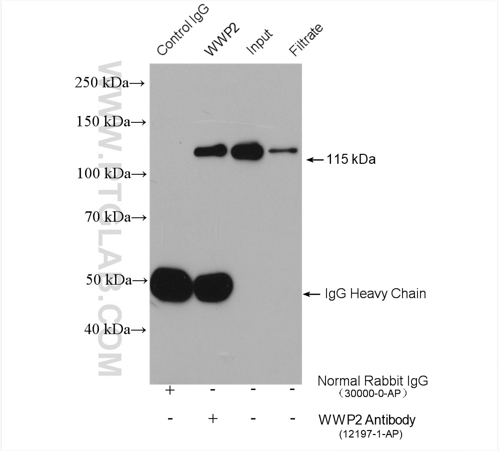 Immunoprecipitation (IP) experiment of A549 cells using WWP2 Polyclonal antibody (12197-1-AP)