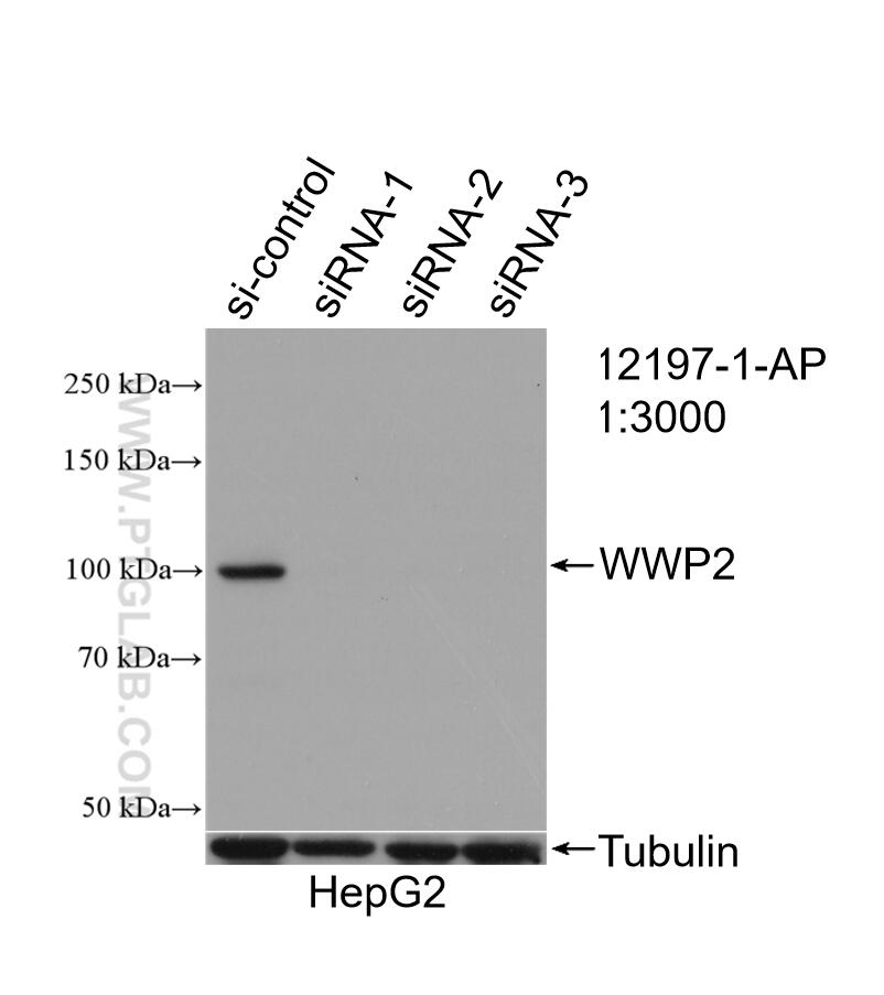 Western Blot (WB) analysis of HepG2 cells using WWP2 Polyclonal antibody (12197-1-AP)