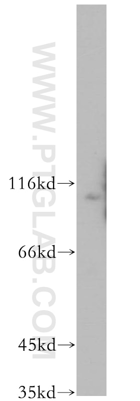 Western Blot (WB) analysis of A549 cells using WWP2 Polyclonal antibody (12197-1-AP)