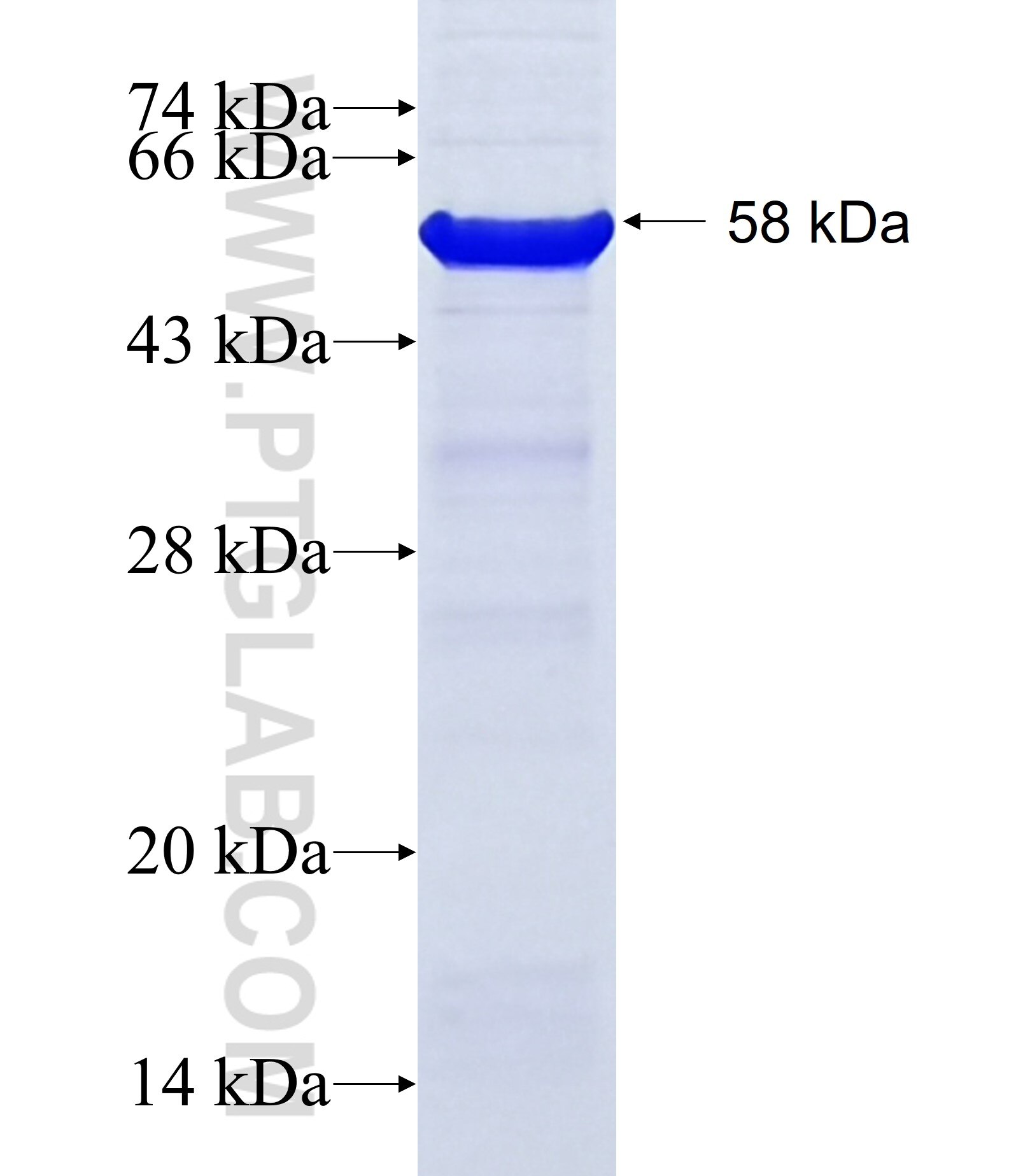 WWP2 fusion protein Ag29179 SDS-PAGE