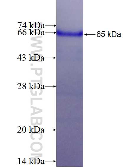 WWP2 fusion protein Ag2835 SDS-PAGE